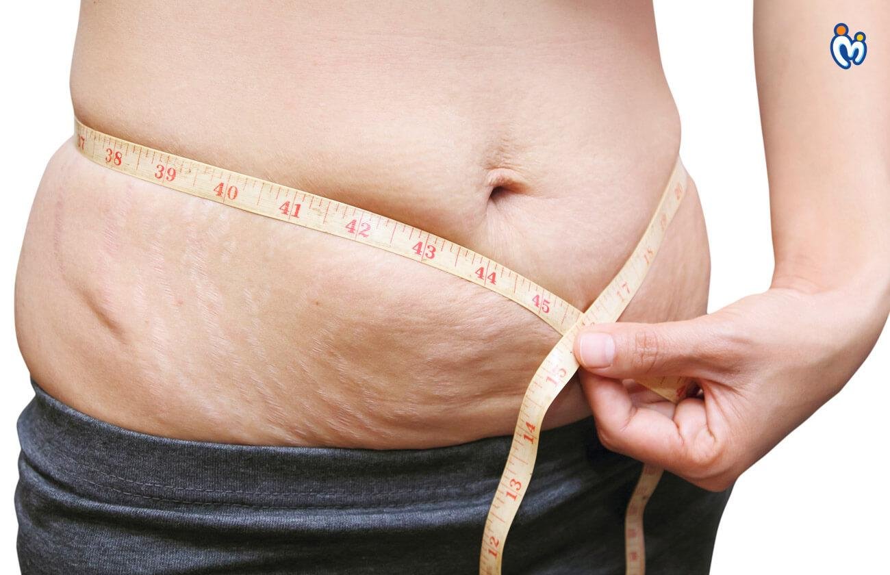 Post-Pregnancy Weight Loss Tips